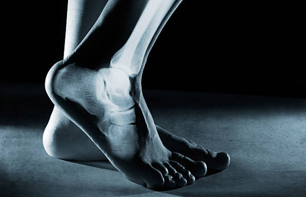 Foot X Rays
