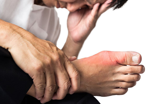 Stop Gout Pain