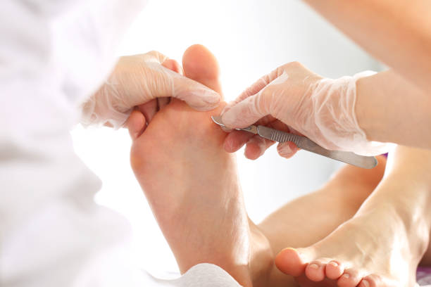 How To Prevent Calluses On Feet? (6 Effective Tips)